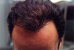 Male Hair example 3 after